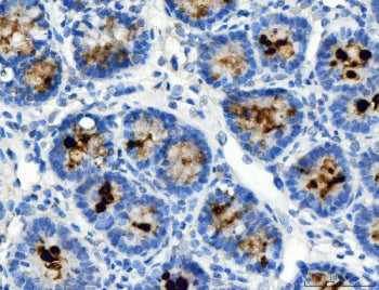 IHC staining of FFPE rat stomach tissue with ATP4A antibody. HIER: boil tissue sections in pH8 EDTA 