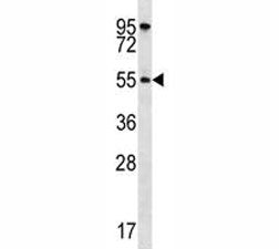 AKT1 Antibody