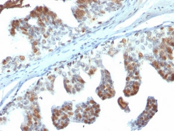PTEN Antibody