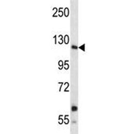 Insulin receptor R antibody western blot analysis in A549 lysate. Expected molecular weight: ~80 kDa