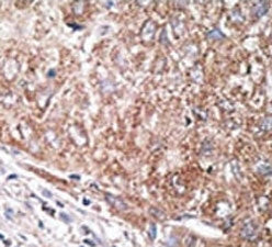 Nestin Antibody