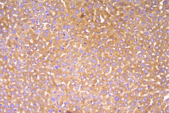 IHC staining of FFPE mouse liver with Cfh antibody. HIER: boil tissue sections in pH8 EDTA for 20 mi