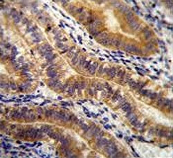 Angiopoietin 2 Antibody / ANG2