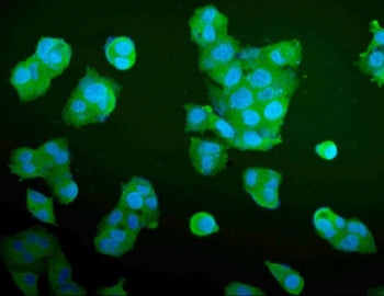 Immunofluorescent staining of FFPE human HepG2 cells with ALDOA antibody (green) and DAPI nuclear stain (blue). HIER: steam section in pH6 citrate buffer for 20 min.