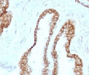Cytokeratin 5 Antibody / KRT5