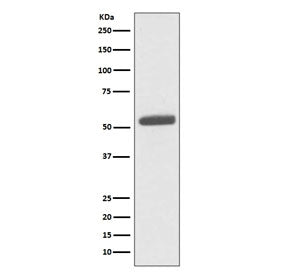 Western blot testing of human HeLa cell lysate with PKM2 antibody. Predicted molecular weight ~58 kD