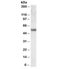 Western blot testing of human lung lysate with Cytokeratin 13 antibody at 0.1ug/ml. Predicted molecu