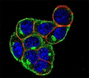 Cyclin D Antibody (CCND1)