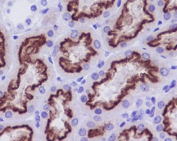 IHC staining of FFPE human kidney tissue with CUBN antibody. HIER: boil tissue sections in pH6, 10mM