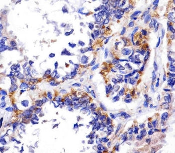 REDD-1 Antibody / DDIT4