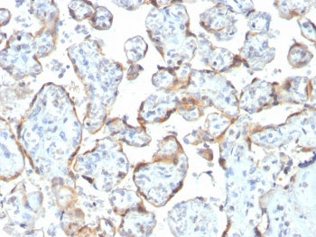 TIMP2 Antibody