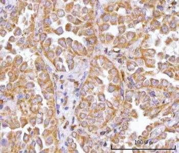 TRNT1 Antibody / tRNA-nucleotidyltransferase 1 / CGI-47