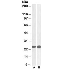 Western blot of human thymus (A) and MOLT4 (B) lysates with GRB2 antibody at 0.05ug/ml. Predicted mo