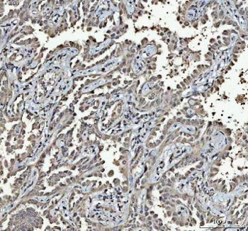 RTCB Antibody / C22orf28