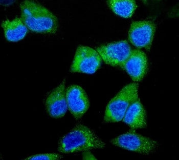ITCH Antibody / AIF4