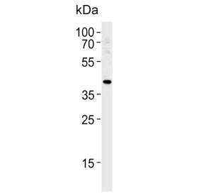 TBX1 Antibody