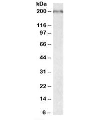 Western blot testing of fetal mouse brain lysate with Robo1 antibody at 0.05ug/ml. Predicted molecul