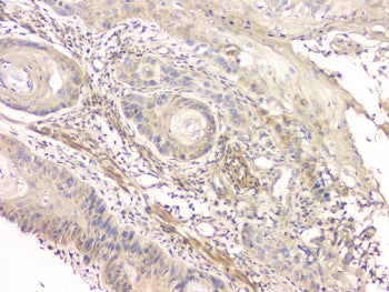 CCR10 Antibody