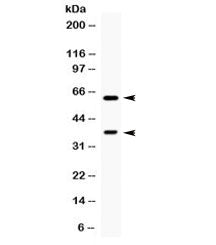 Western blot testing of human HeLa cell lysate with TPP1 antibody. Expected molecular weight: 61/34 