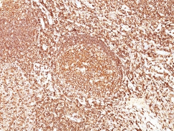 IHC staining of FFPE human tonsil tissue with CD45 antibody (clone F10-89-4). HIER: boil tissue sect