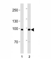 ACE2 antibody western blot analysis in MDA-MB-453, MCF-7 lysate. Predicted molecular weight: 90-100 
