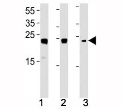 HMGB2 Antibody