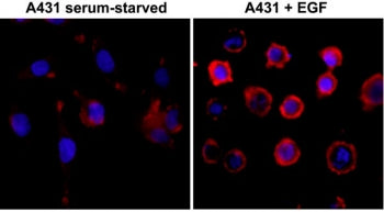 Phosphotyrosine Antibody