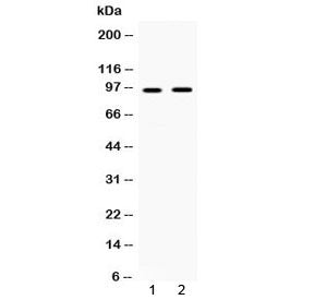 Western blot testing of human 1) HepG2 and 2) SKOV3 cell lysate with IFNGR1 antibody at 0.5ug/ml. Pr