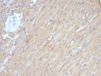 IHC staining of FFPE human smooth muscle with recombinant CALD1 antibody (clone rCALD1/7266). HIER: 