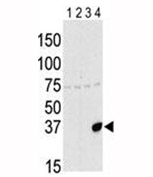 Aurora-C Antibody (AURKC)