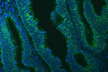 TXNDC5 Antibody / Thioredoxin domain-containing protein 5
