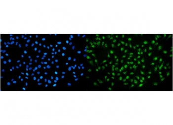 UHRF2 Antibody / NIRF