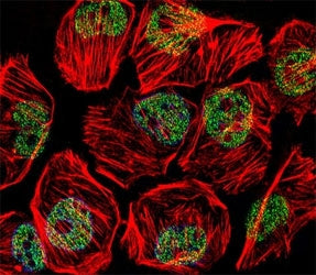TBP Antibody (TATA Binding Protein)