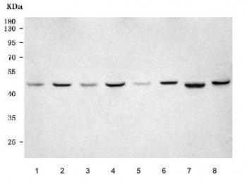 Western blot testing of 1) human CCRF-CEM, 2) human MOLT4, 3) human SK-O-V3, 4) human MCF7, 5) rat k