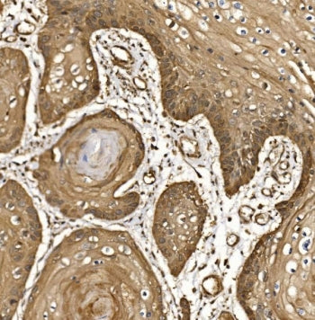 EIF5 Antibody / Eukaryotic translation initiation factor 5