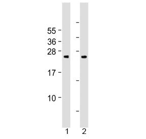 Grancalcin Antibody / GCA (N-Terminal Region)