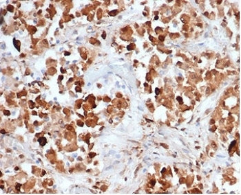 IHC staining of FFPE human pituitary tissue with recombinant GH1 antibody (clone rGH/4887). HIER: bo