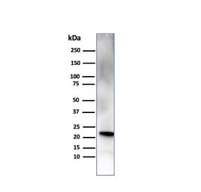 Western blot testing of human pancreas tissue with RBP4 antibody. Predicted molecular weight ~23 kDa