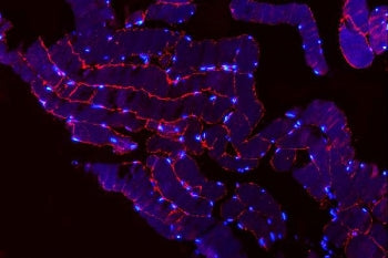 Immunofluorescent staining of FFPE human skeletal muscle tissue with TRIM72 antibody (red) and DAPI 