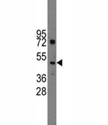 Ihh Antibody