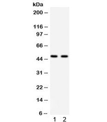 PTOV1 Antibody