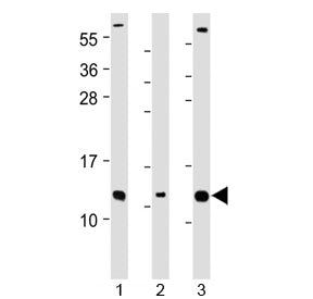 Western blot testing of human 1) Caco-2, 2) RMPI-8226 and 3) SH-SY5Y cell lysate with CKS2 antibody 