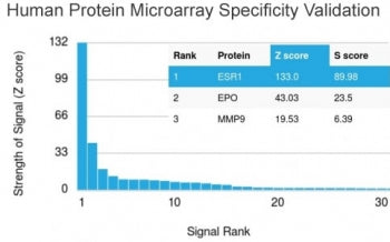 Analysis of HuProt(TM) microarray containing more than 19,000 full-length human proteins using Estro