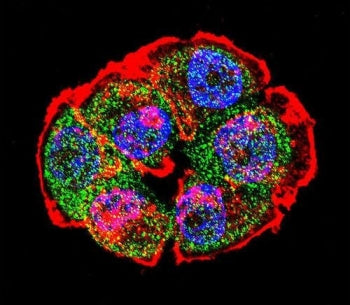 Beta Catenin Antibody