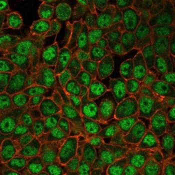 USF2 Antibody / Upstream stimulatory factor 2