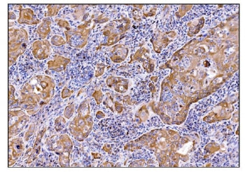 Deoxyhypusine synthase Antibody / DHPS / DHS