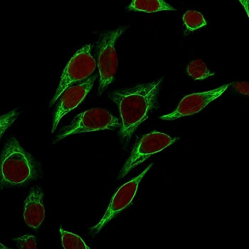 Cytokeratin 18 Antibody