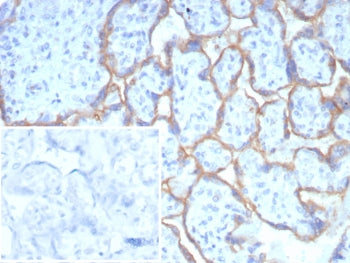PD-L1 Antibody / B7-H1 / CD274