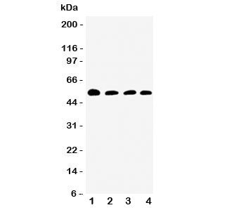 Western blot testing of Antithrombin III antibody and Lane 1: rat testis; 2: SMMC-7721; 3: Jurkat; 4