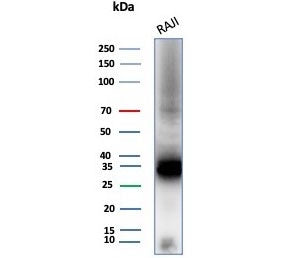 Western blot testing of human Raji cell lysate with CD74 antibody (clone CLIP/8680R). Expected molec